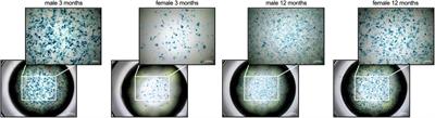 Sex- and age-related differences in the inflammatory properties of cardiac fibroblasts: impact on the cardiosplenic axis and cardiac fibrosis